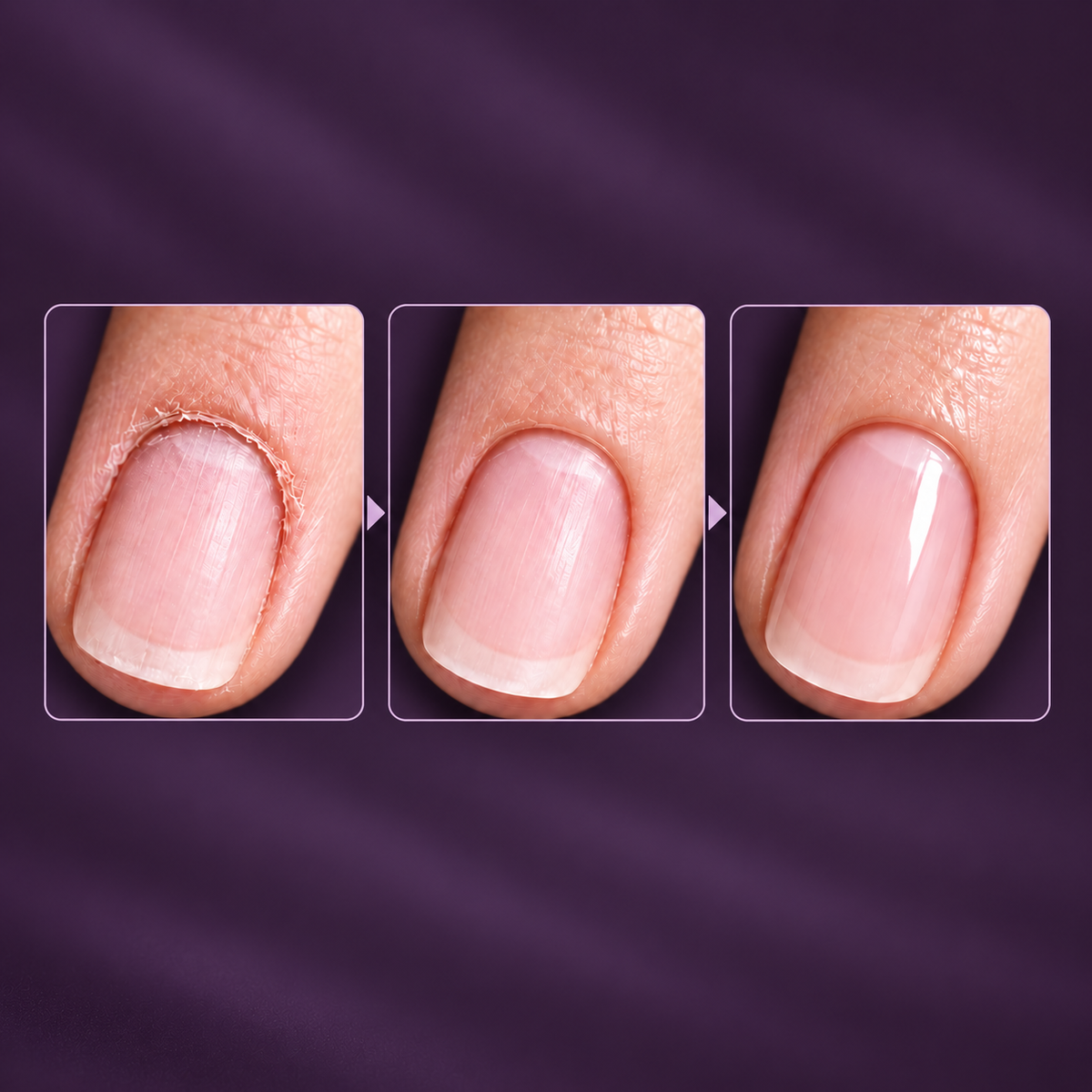 Cuticle Easy Care™ 2-in-1 Pen