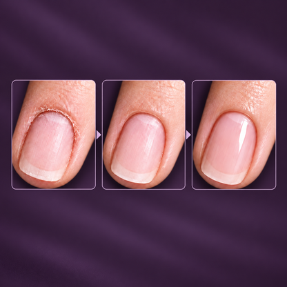 Cuticle Easy Care™ 2-in-1 Pen