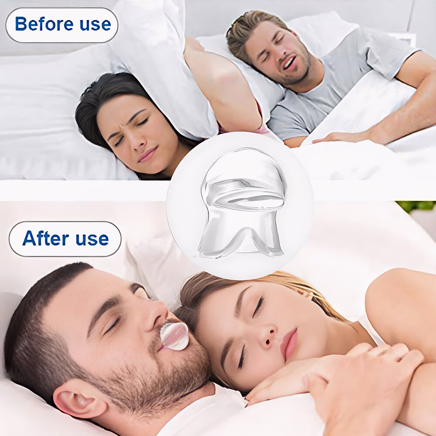 SleepEase Mouthguard